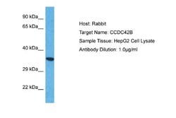 CCDC42B Rabbit anti-Human, Polyclonal, Novus Biologicals 0.1 mL | Buy Online | Novus Biologicals | Fisher Scientific